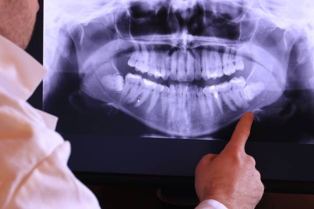 Best Emergency Broken Tooth Repair in Lewiston, ME