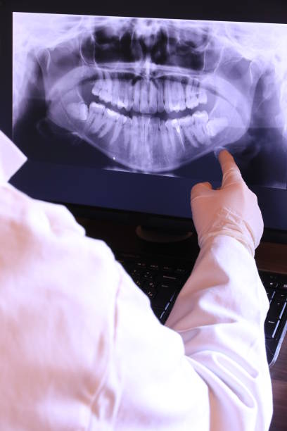 Best Emergency Dental Surgery in Lewiston, ME