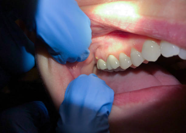 Trusted ME Emergency Dentist Experts
